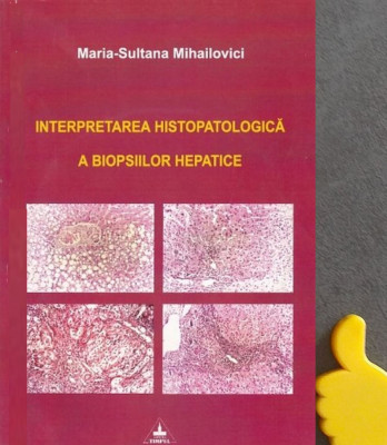 Interpretarea histopatologica a biopsiilor hepatice Maria-Sultana Mihailovici foto