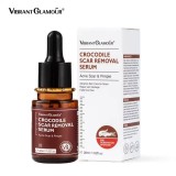 Ser de reparare a cicatricilor cu extract de crocodil tratamentul acneei indepărtarea vergeturilor albirea cicatricilor de la acnee 30 ml Vibrant Glam