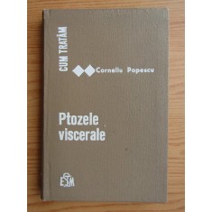 Corneliu Popescu - Cum tratam ptozele viscerale (1972)