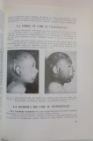 FOTOGRAFIE MEDICALA , 1978