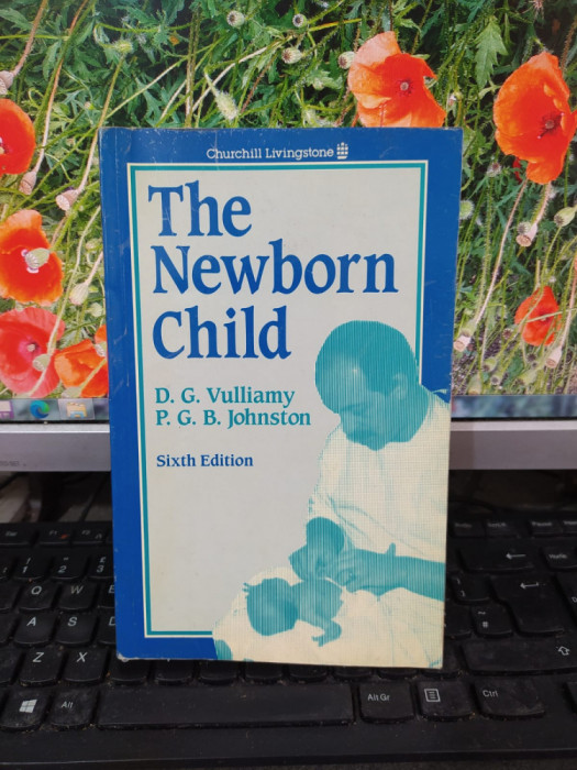 The Newborn Child, Sixth Edition, Vulliamy și Johnston, Edinburgh..., 1987, 170