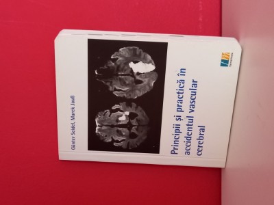 Principii si practica in accidentul vascular cerebral G&amp;uuml;nter Seidel, Marek J. (2013) foto