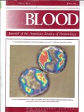 Blood Journal Societatea Americana Hematologie 1 Iunie 1998 Editura Saunders 288 Pagini Stare Buna Anaparitie 1998