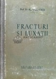 Fracturi si luxatii - 1952 - Alexandru Radulescu (W91)