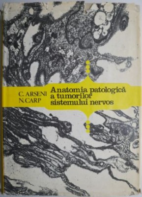 Anatomia patologica a tumorilor sistemului nervos &amp;ndash; C. Arseni foto