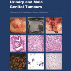 Urinary and Male Genital Tumours