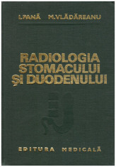 Radiologia stomacului si duodenului foto