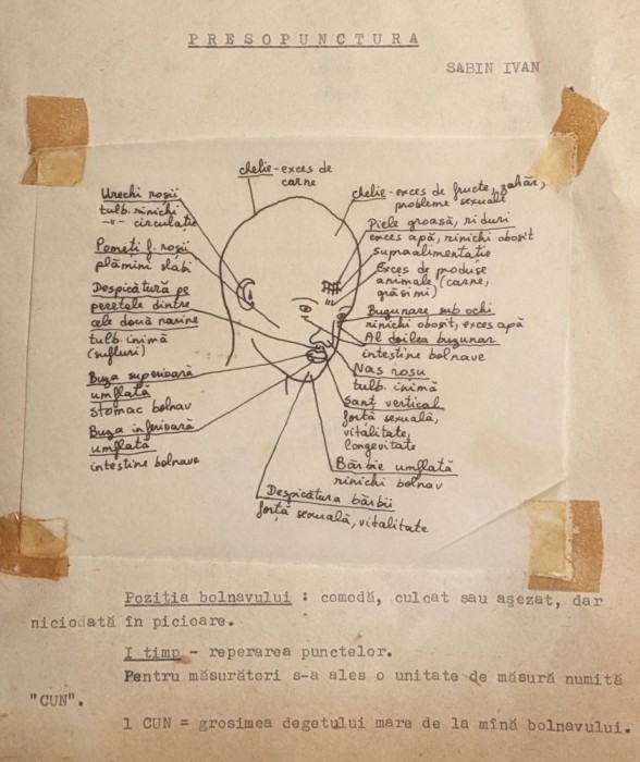 RAR Manuscris PRESOPUNCTURA &ndash; Sabin Ivan Text batut la masina. Ilustratii de mana pe hartie calc. Format 21x30cm Stare conform poze