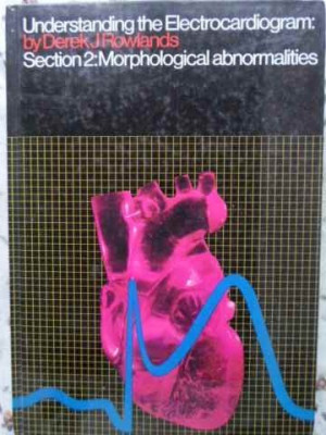 UNDERSTANDING THE ELECTROCARDIOGRAM: SECTION 2: MORPHOLOGICAL ABNORMALITIES-DEREK J ROWLANDS foto