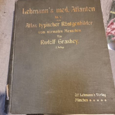 Rudolf Grashey - Lehmanns Medizinische Atlanten. Atlas Typischer Rontgenbilder von Normalen Menschen (Band V)