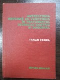 Antrectomia asociata cu vagotomia in tratamentul ulcerului gastric si duodenal- Traian Stoica