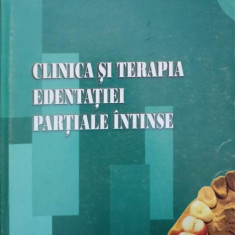 CLINICA SI TERAPIA EDENTATIEI PARTIALE INTINSE-VASILE BURLUI, NORINA FORNA