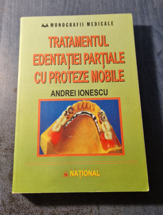 Tratamentul edentatiei partiale cu proteze mobile Andrei Ionescu