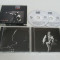 Eros Ramazzotti &ndash; Eros in concert 2 x CD originale 1991 Comanda minima 100 Lei