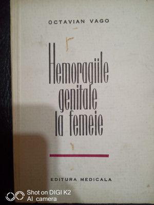 Hemoragiile genitale la femeie-Dr.Octavian Vago foto