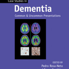 Case Studies in Dementia: Volume 2: Common and Uncommon Presentations