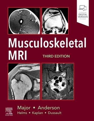 Musculoskeletal MRI foto