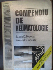 Compendiu de reumatologie-Eugen D.Popescu, Ruxandra Ionescu foto