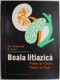 Boala litiazica piatra la rinichi piatra la ficat &ndash; Tr. Caracas