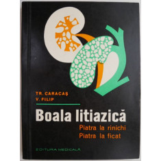 Boala litiazica piatra la rinichi piatra la ficat &ndash; Tr. Caracas