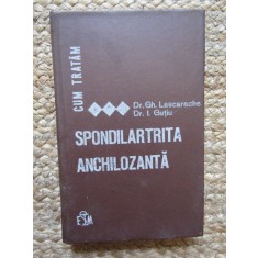 CUM TRATAM SPONDILARTRITA ANCHILOZANTA-GH. LASCARACHE, I. GUTIU