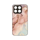 Husa BestCase&reg; Slim Glassy, Compatibila Cu Honor X8 5G, Rose Marble, G 1253