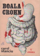 Boala Crohn foto