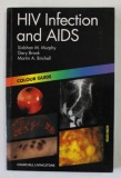 HIV INFECTION AND AIDS by SIOBHAN M. MURPHY ...MARTIN A. BIRCHALL , COLOUR GUIDE , 2000