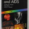 HIV INFECTION AND AIDS by SIOBHAN M. MURPHY ...MARTIN A. BIRCHALL , COLOUR GUIDE , 2000