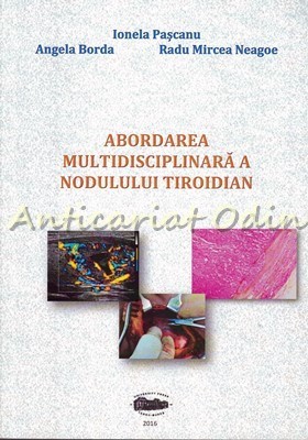 Abordarea Multidisciplinara A Nodulului Tiroidian - Ionela Pascanu foto