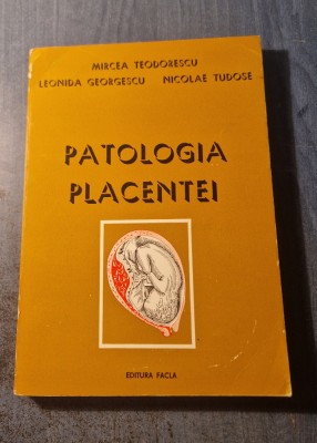 Patologia placentei Mircea Teodorescu foto